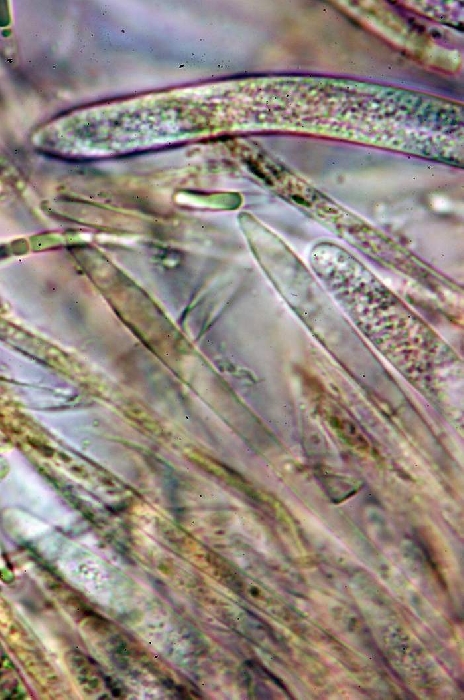 macrostoma