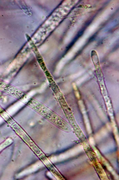 macrostoma