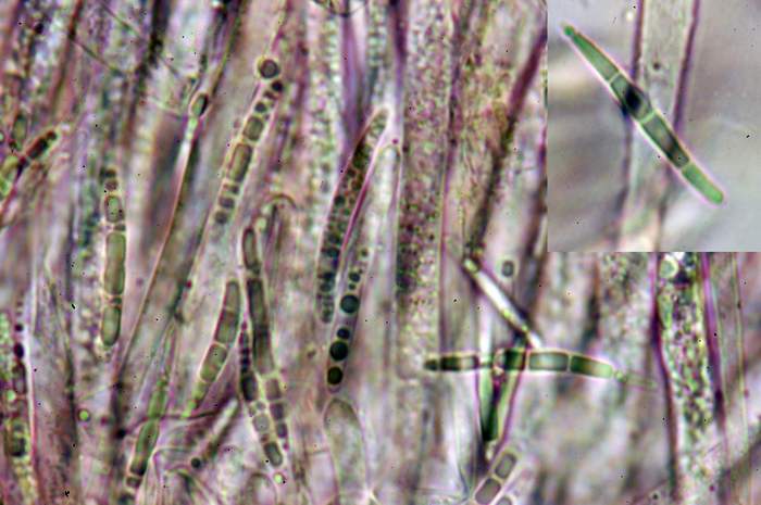 macrostoma