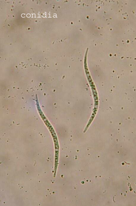 macrostoma