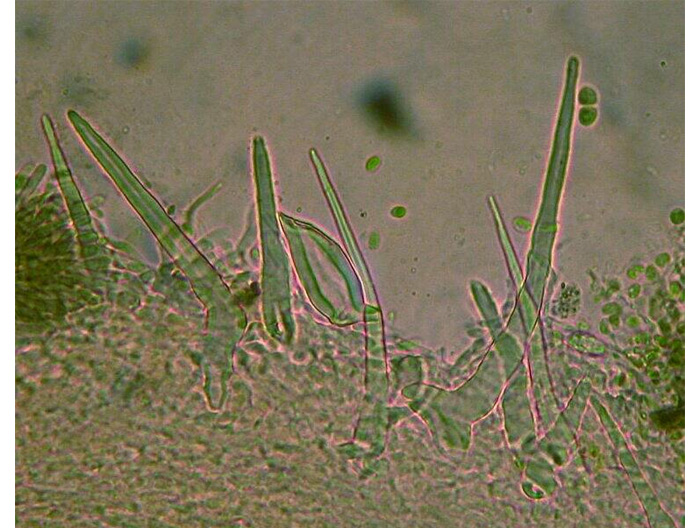 macrostoma