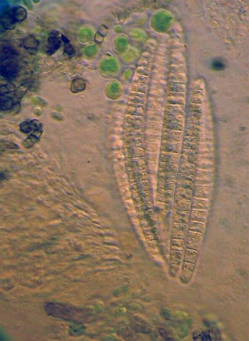 macrostoma