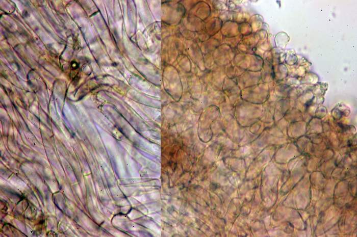 macrostoma