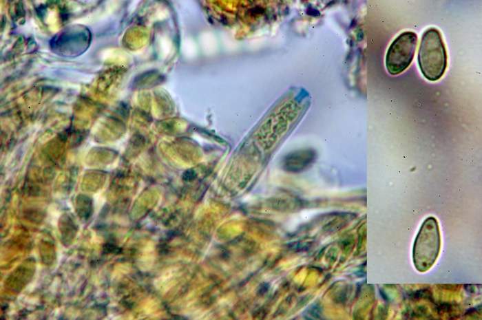 macrostoma