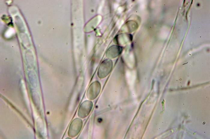 macrostoma