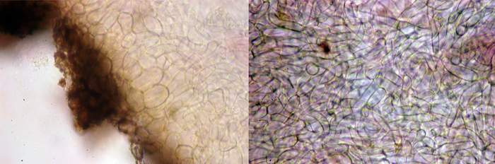 macrostoma