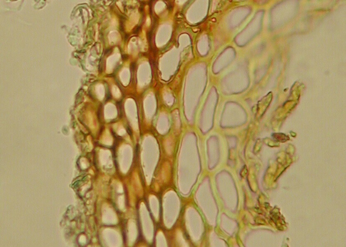 macrostoma