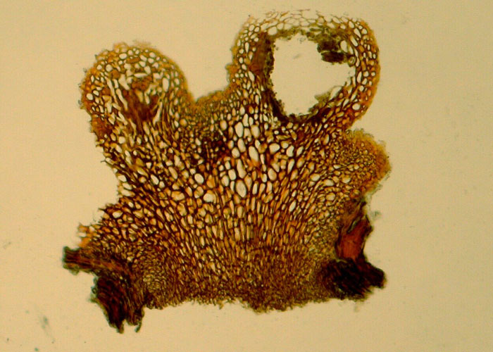macrostoma