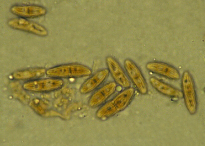 macrostoma