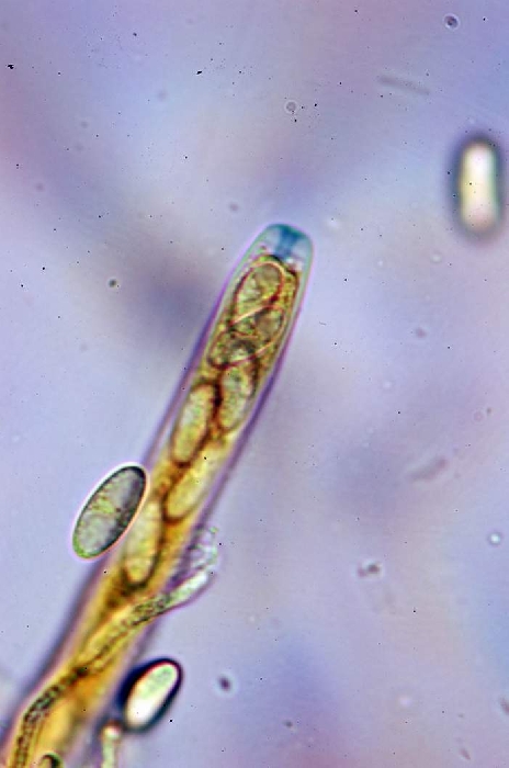 macrostoma