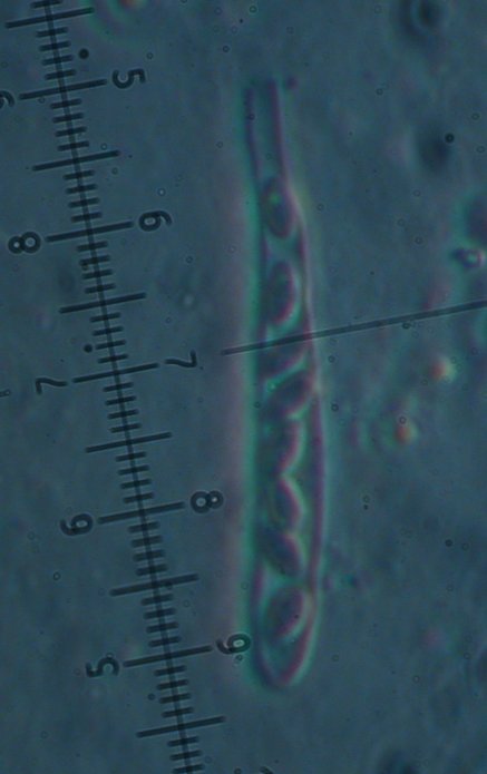 macrostoma