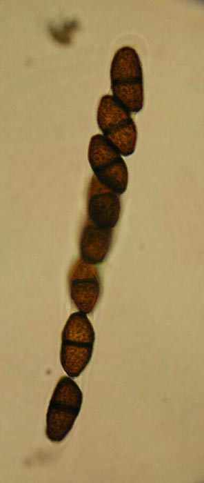 macrostoma