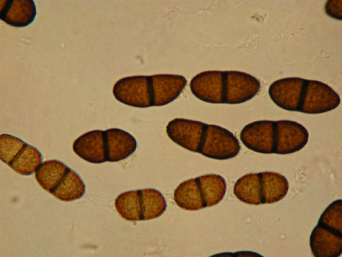 macrostoma