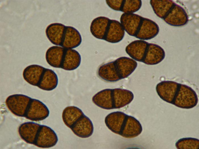 macrostoma