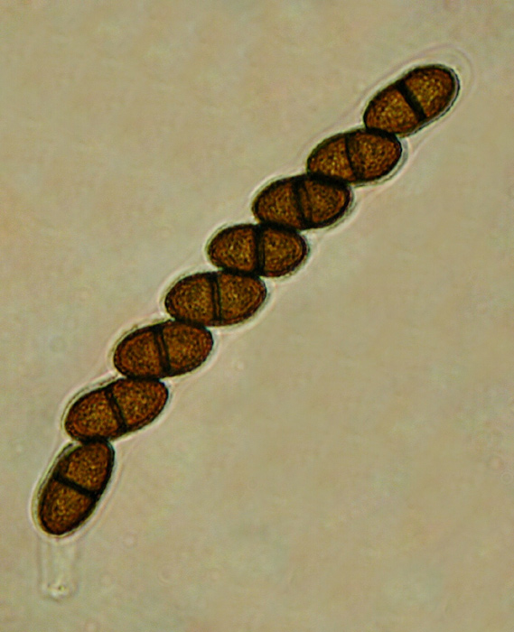 macrostoma