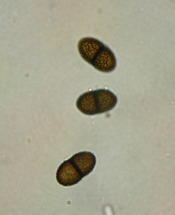 macrostoma