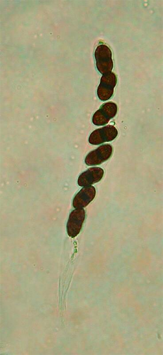 macrostoma