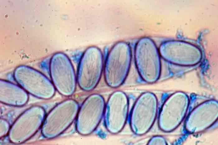 macrostoma