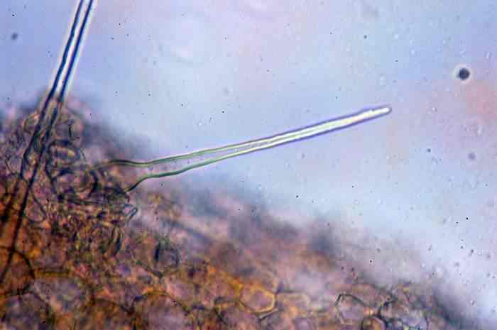 macrostoma