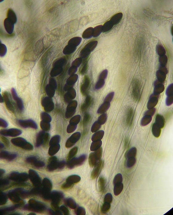 macrostoma