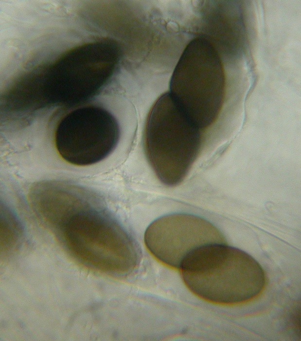 macrostoma