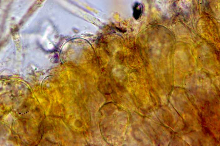 macrostoma