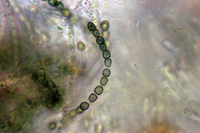 macrostoma