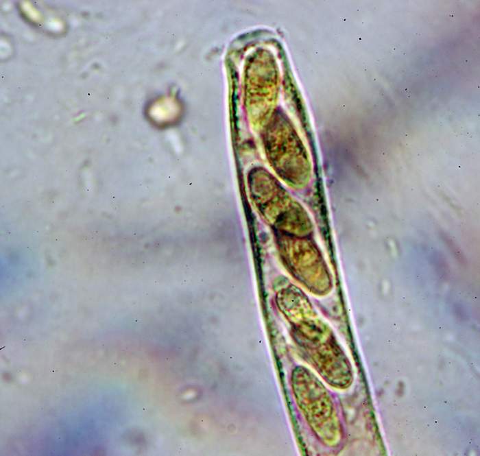 macrostoma
