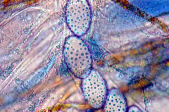 macrostoma