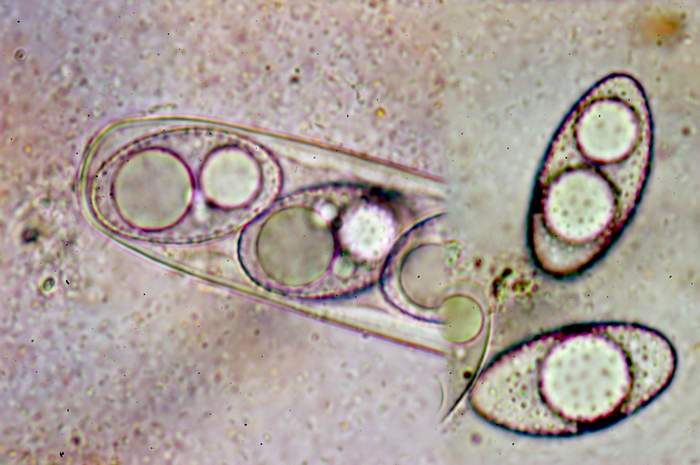 macrostoma