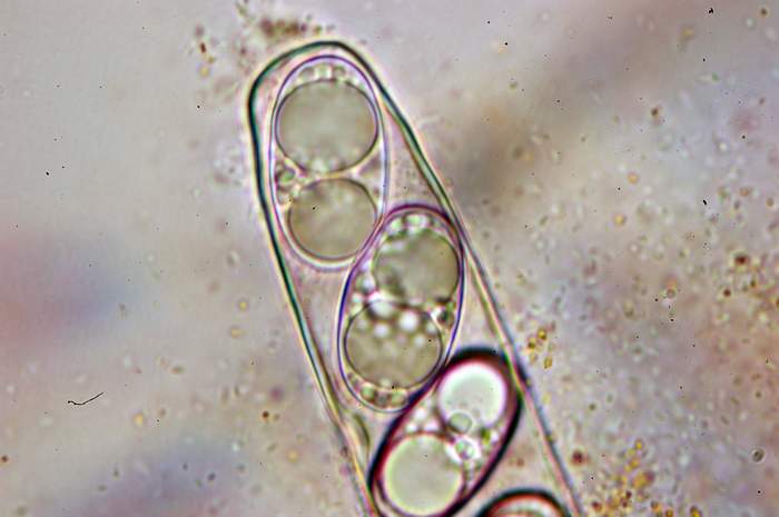 macrostoma