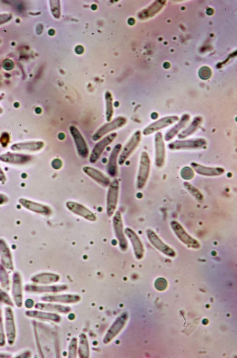 macrostoma