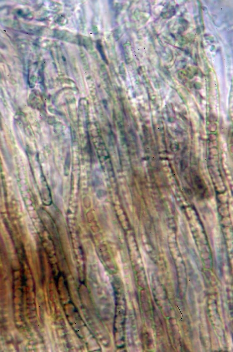 macrostoma
