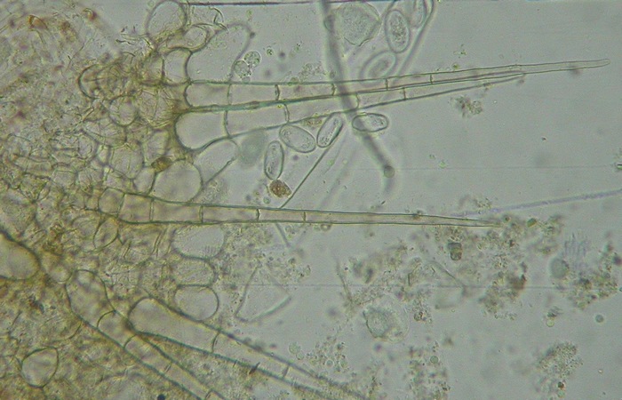 macrostoma