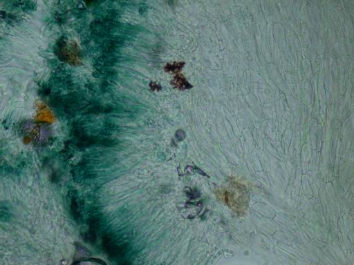 macrostoma
