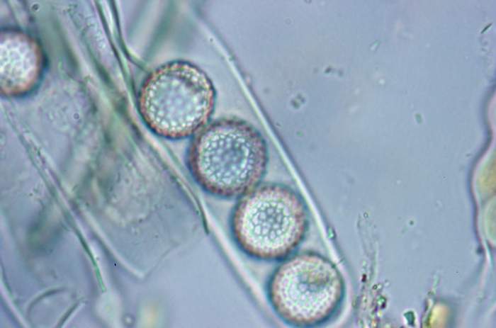macrostoma
