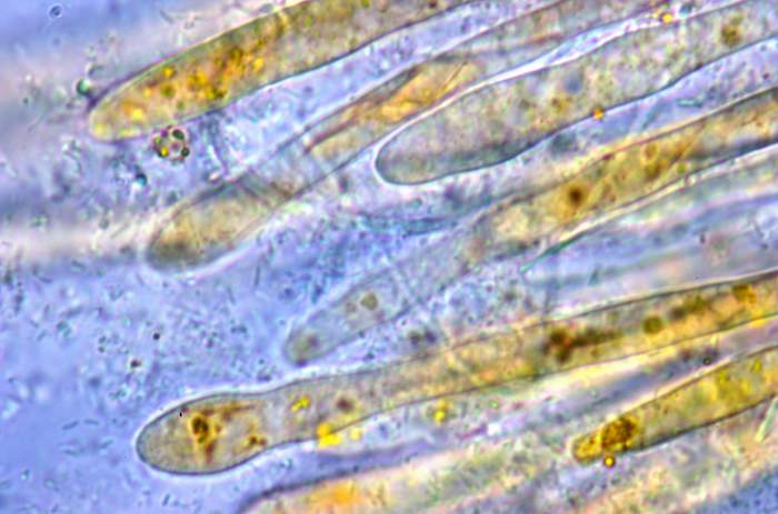 macrostoma