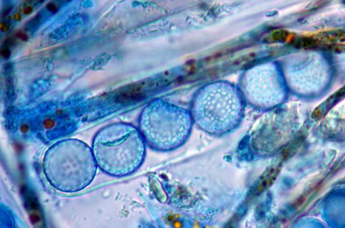 macrostoma