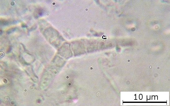 macrostoma