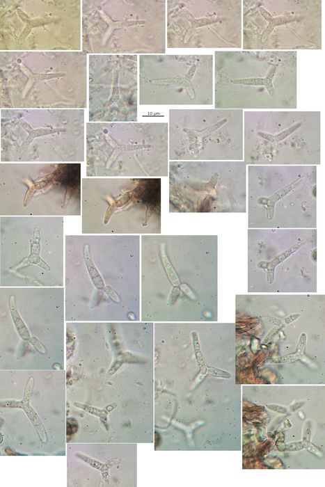 macrostoma