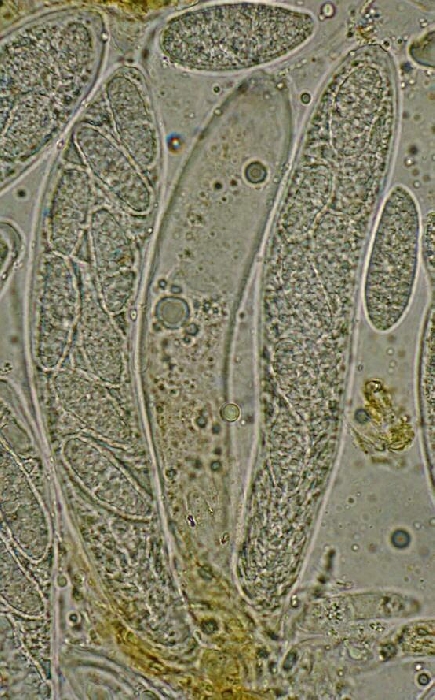macrostoma