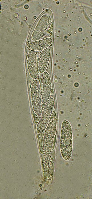 macrostoma