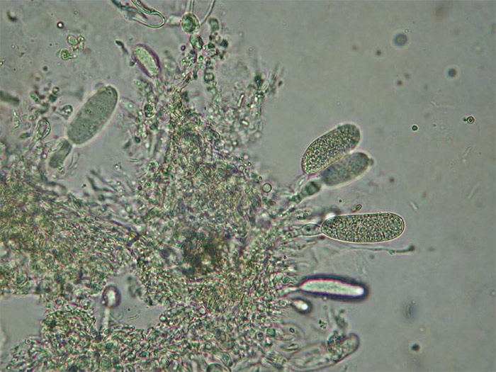 macrostoma