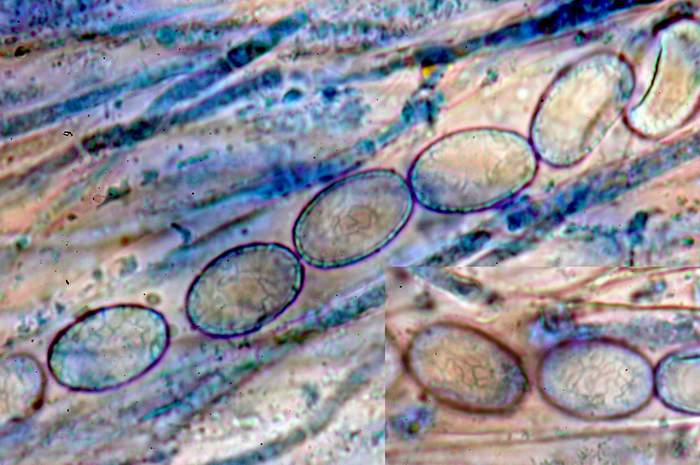 macrostoma