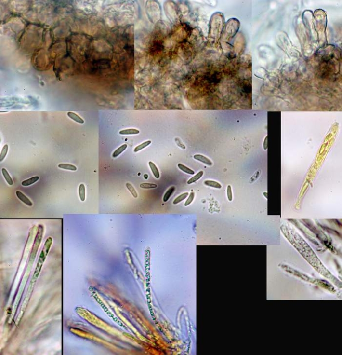 macrostoma