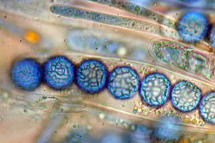 macrostoma