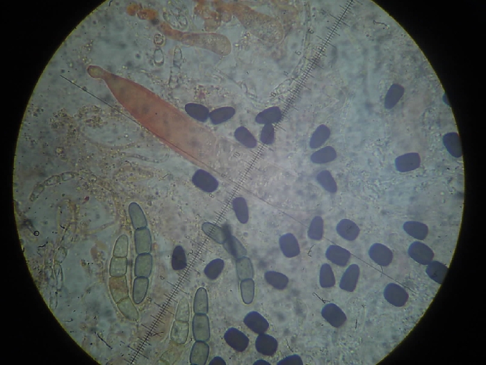 macrostoma