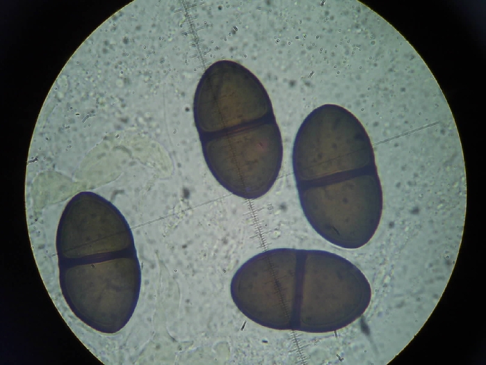 macrostoma