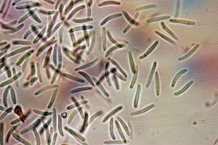 macrostoma