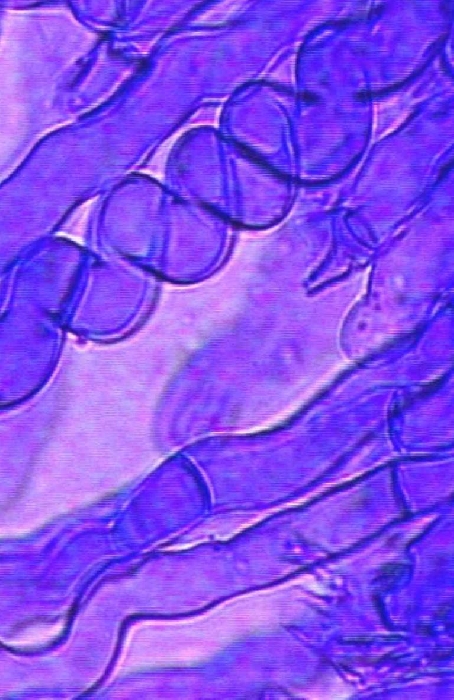 macrostoma
